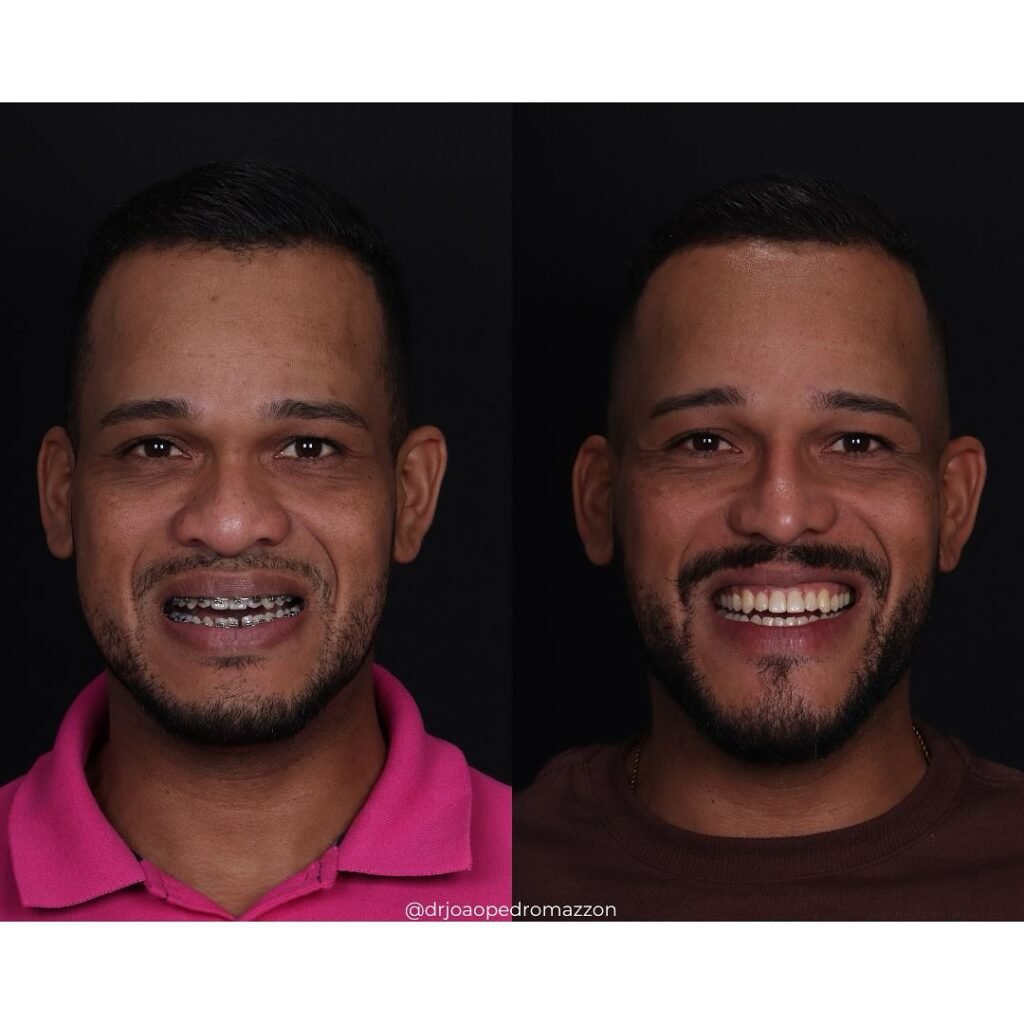 Instagram post from drjoaopedromazzon. This post is in position 2.