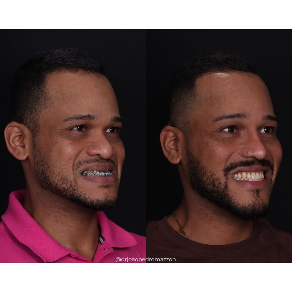 Instagram post from drjoaopedromazzon. This post is in position 4.