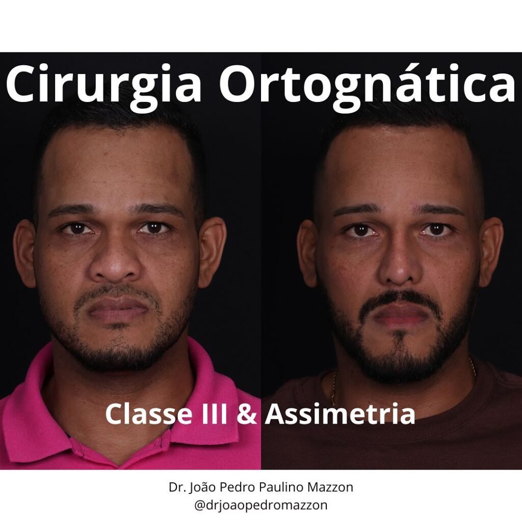 Instagram post from drjoaopedromazzon. This post is in position 0.