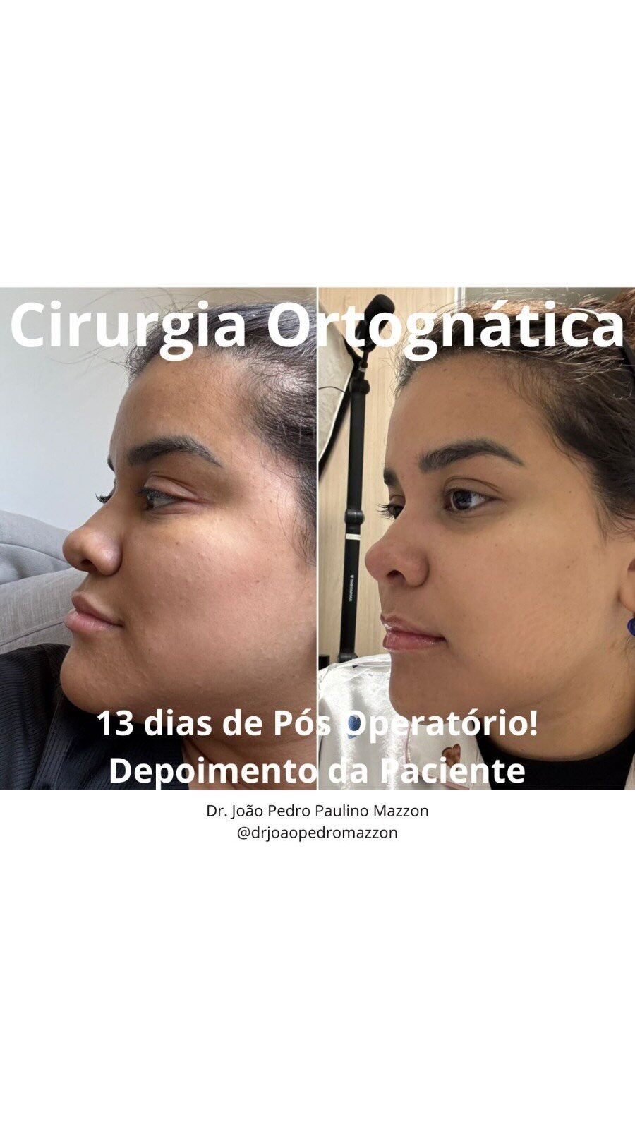 Instagram post from drjoaopedromazzon. This post is in position 1.