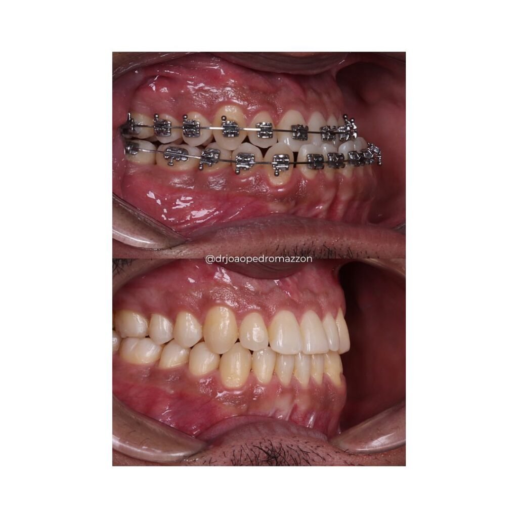 Instagram post from drjoaopedromazzon. This post is in position 12.