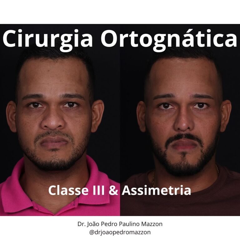 Instagram post from drjoaopedromazzon. This post is in position 1.