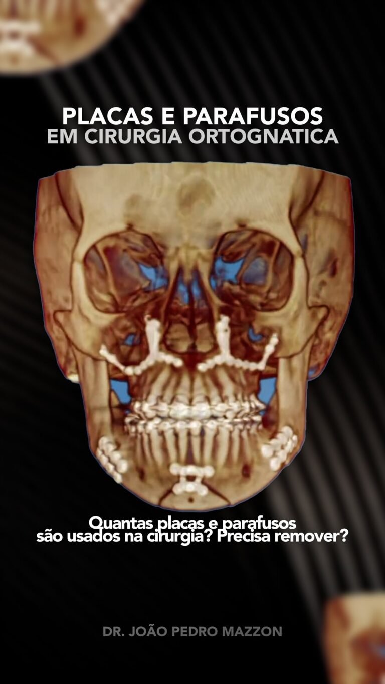 Instagram post from drjoaopedromazzon. This post is in position 5.